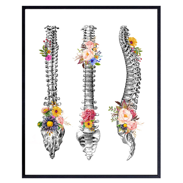 Orthopedic Human Anatomy Medical Poster - Spine, Back, Backbone Wall Art Decor for Doctor Office, Clinic - Gift for ER Nurse, RN, CNA, Physicians Assistant, Physical Therapist, Chiropractic Dr