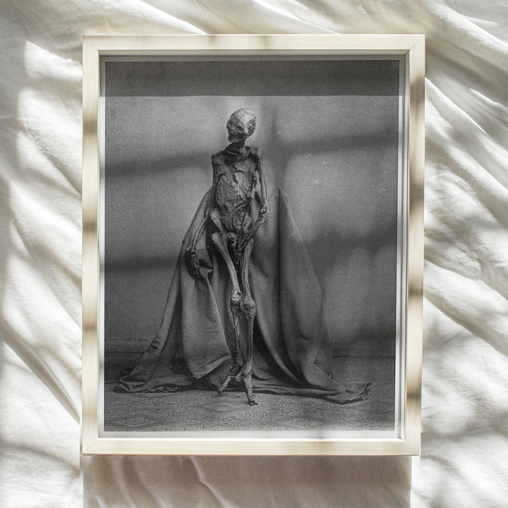 Skeleton Decor - Skull Wall Art - Goth Wall Art - Skull Wall Decor - Pagan Decor - Paganism Gifts - Gothic Home Decoration - Black Magic Accessories - Human Anatomy Picture - Creepy Vintage Photo